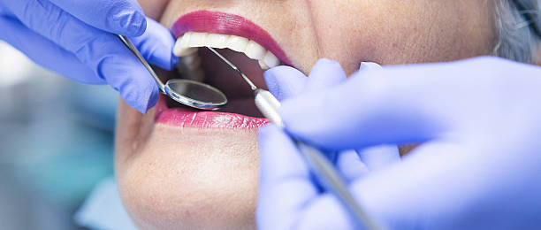 Best Emergency Dentist for Lost Fillings or Crowns in Romney, WV